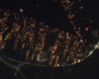 Cacoxenita
